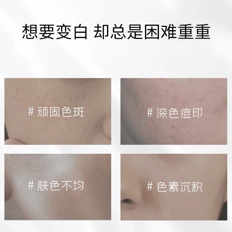 美白淡斑面霜品牌排行前十名：揭秘这10款高效淡斑美白神器！-图片10