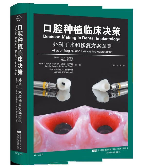 口腔种植临床决策(外科手术和修复方案图集)(精)