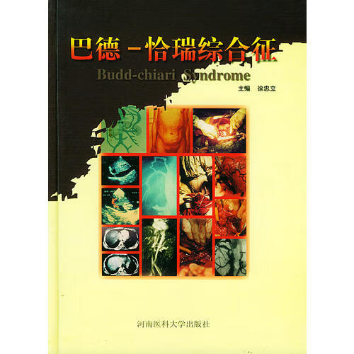 巴德 恰瑞综合征【正版书籍,畅读优品】