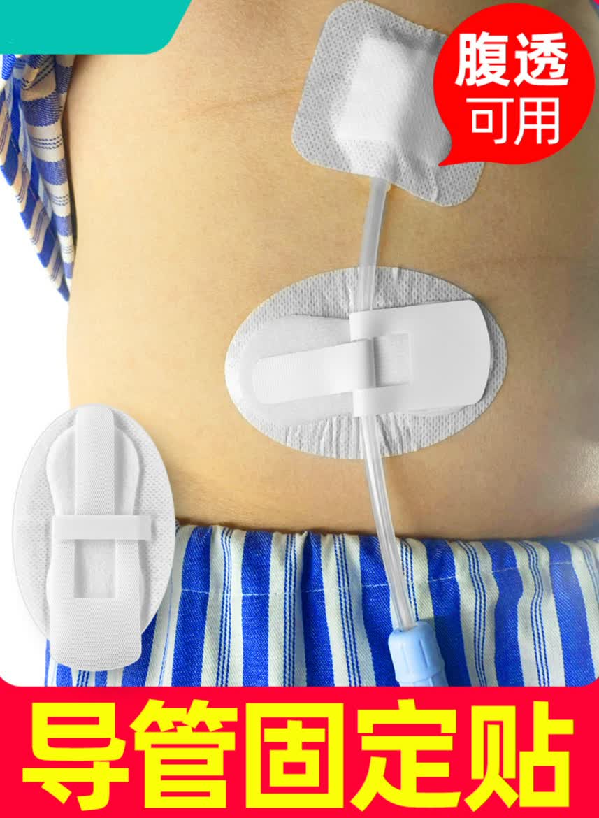 【开票】 引流管固定贴腹透导管 picc导管 胆汁蝴蝶型 10片 一盒50片