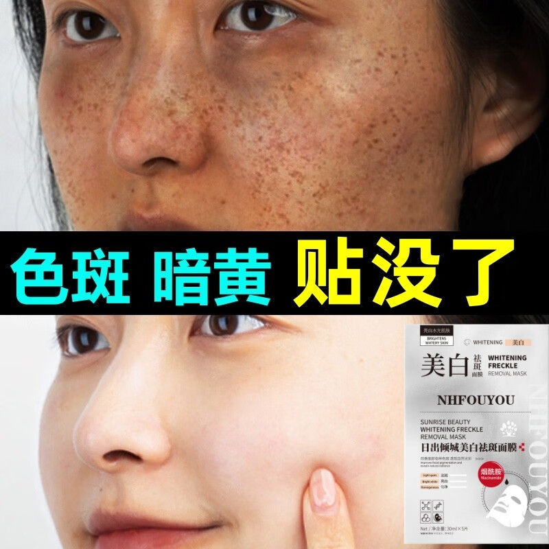 NHFOUYOU面膜美白补水淡斑提亮肤色抗皱祛斑霜去黄褐斑老年斑点斑护肤品 —盒装【老客户补充装】