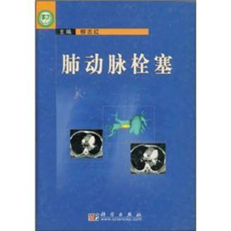 肺动脉栓塞【正版好书,下单速发】