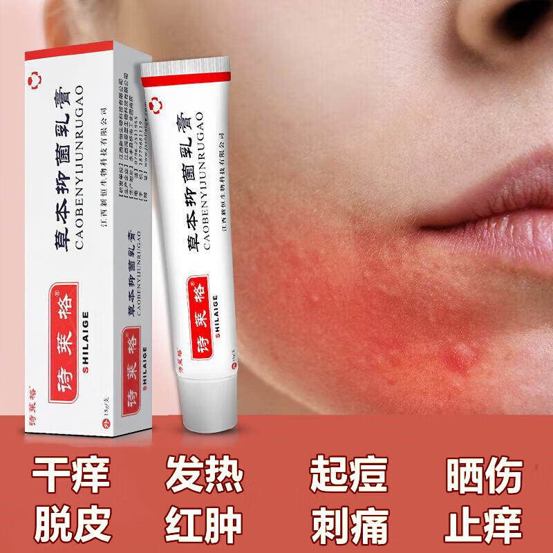 紫外线脸上过敏皮肤太阳晒伤修复霜晒后修复脸部红痒膏 1支装ml