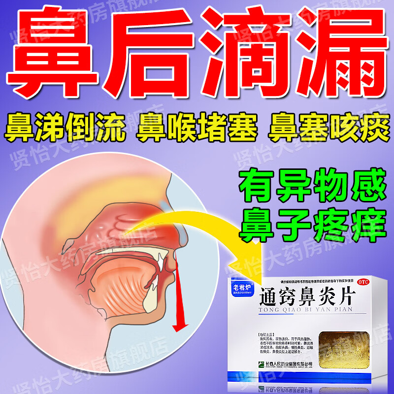 鼻后滴漏综合症鼻涕倒流冷空气过敏咳嗽有特多痰鼻塞时轻时重鼻窦炎