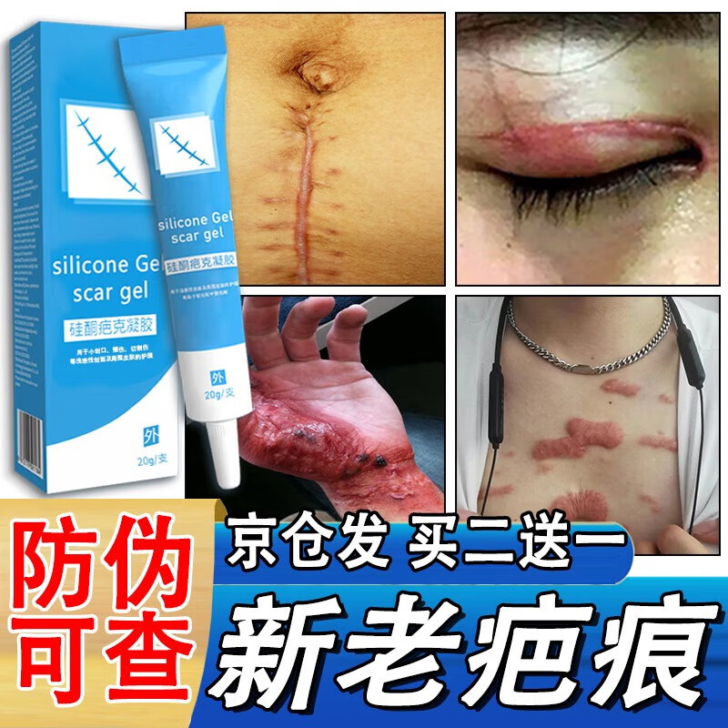 巴克膏去疤膏疤痕修复除淡疤膏透明质酸硅凝胶修复手术疤专用儿童烧