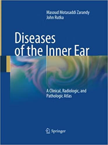 预订 diseases of the inner ear