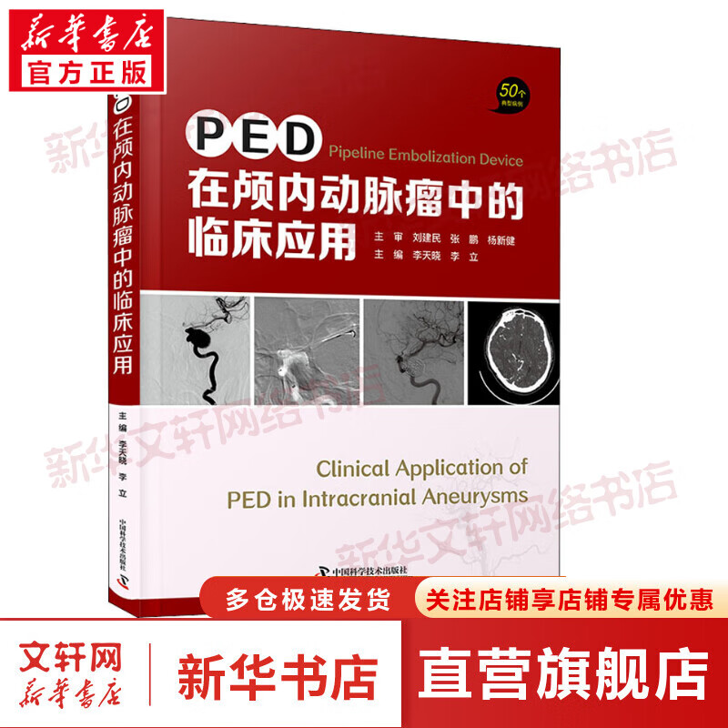 PED在颅内动脉瘤中的临床应用 图书