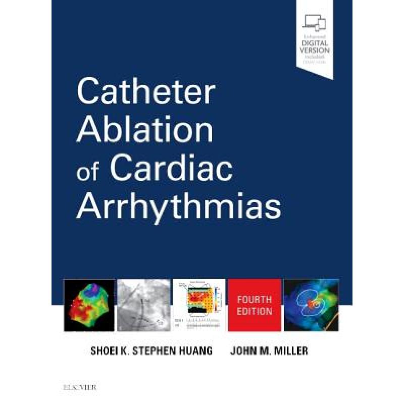 预订 Catheter Ablation of Cardiac Arrhythmias