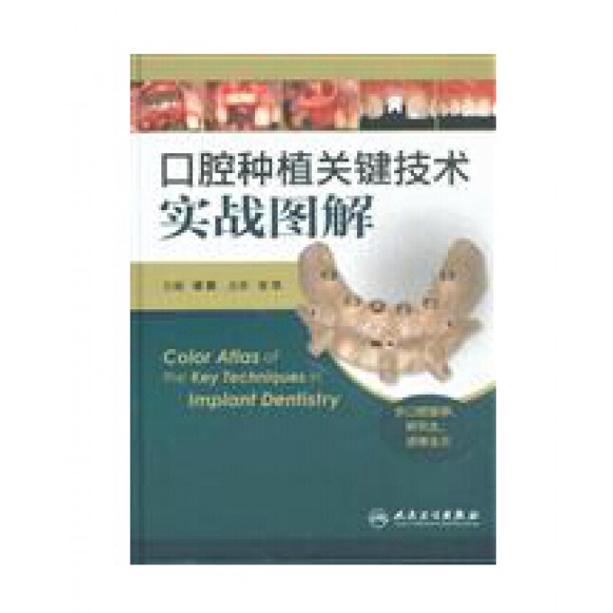 口腔种植关键技术实战图解(供口腔医师研究生进修生用)(精)