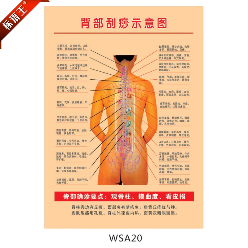 人体穴位挂图中医宣传海报背部刮痧示意图脊背确诊贴画w