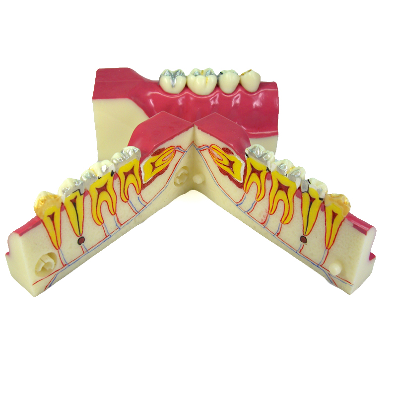 智齿模型图片大全图片