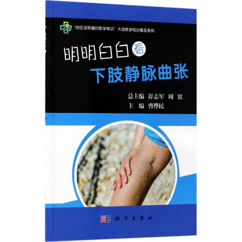 明明白白看下肢静脉曲张