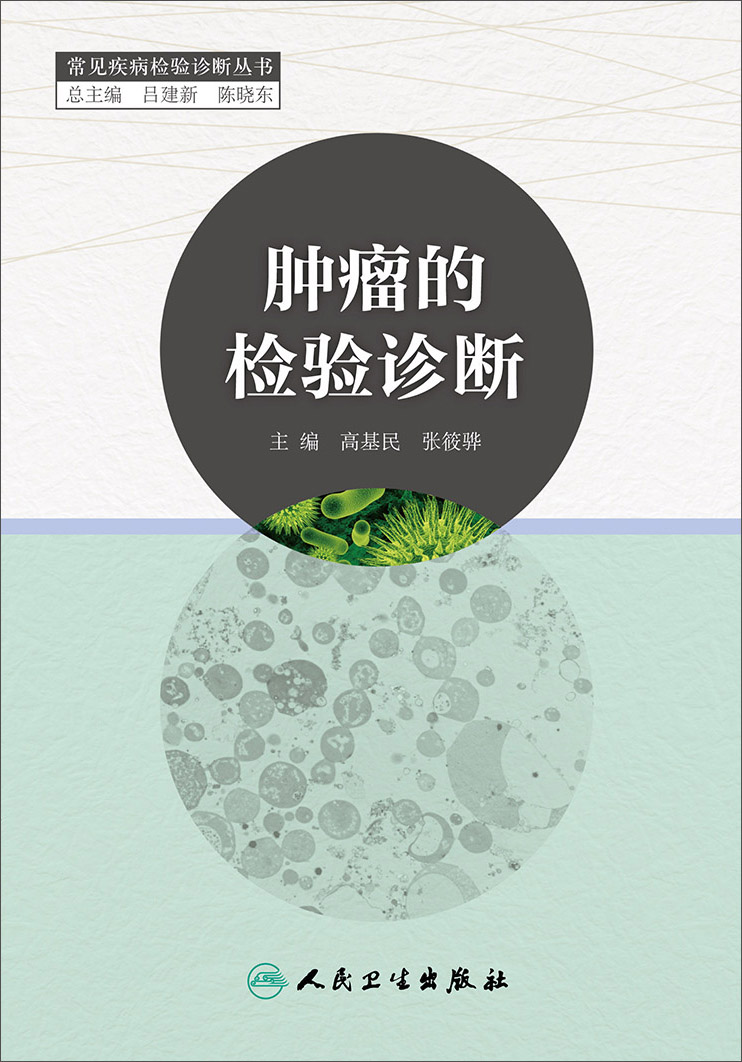 [正版图书]肿瘤的检验诊断
