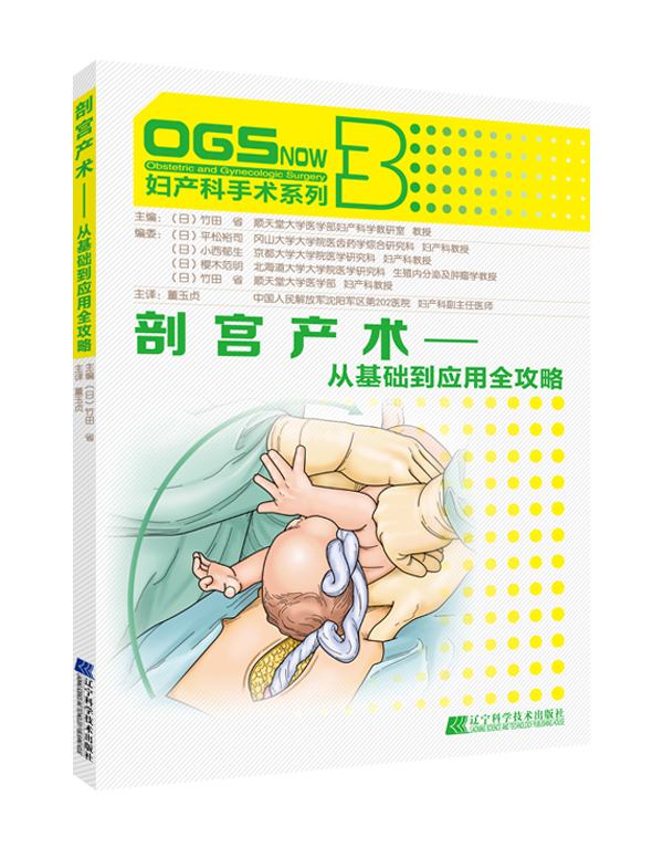 剖宫产术:从基础到应用全攻略