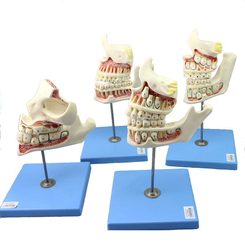 ENOVO颐诺儿童牙列与颌骨发育模型 乳牙恒牙幼儿口腔牙齿发育牙列保健模型
