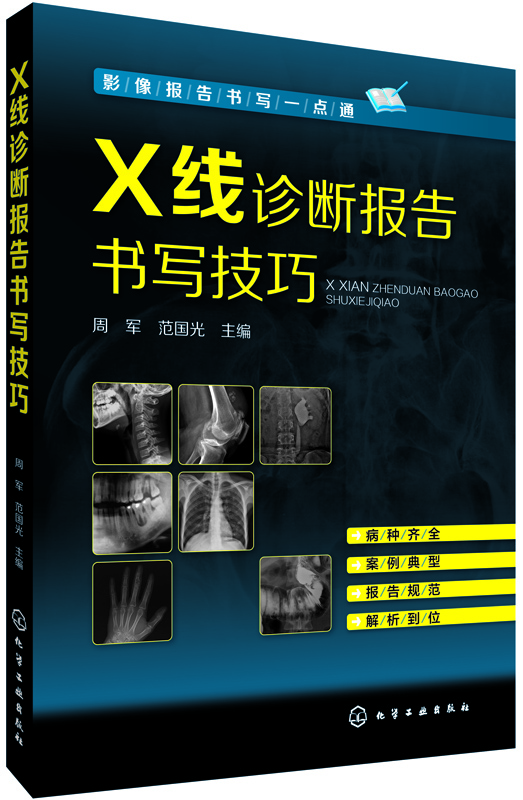 [正版图书]影像报告书写一点通--X线诊断报告书写技巧