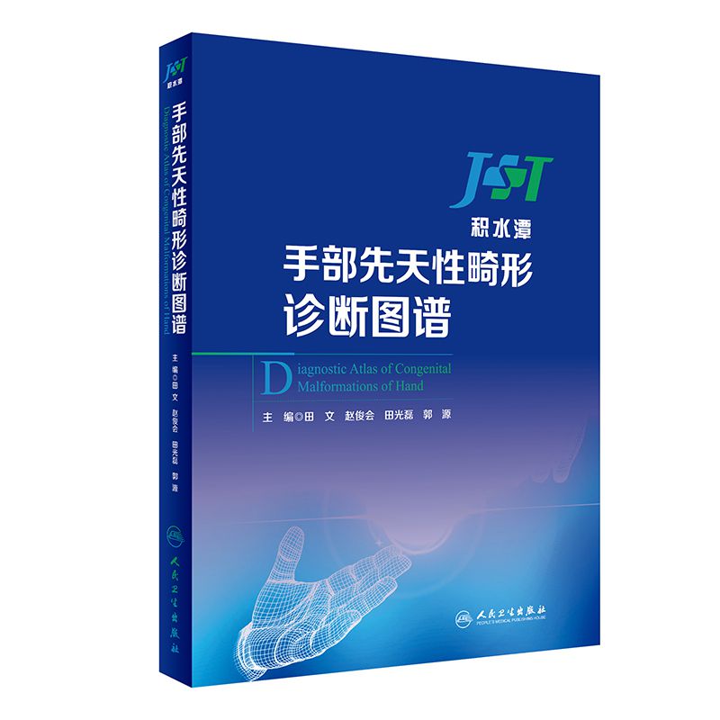 手部先天性畸形诊断图谱(精)