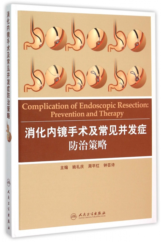 消化内镜手术及常见并发症防治策略(精)