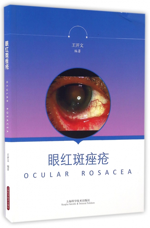 眼红斑痤疮