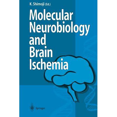 预订 Molecular Biology and Brain Ischemia