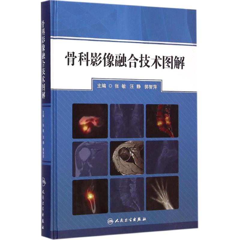 骨科影像融合技术图解