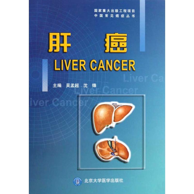 肝癌/中国常见癌症丛书