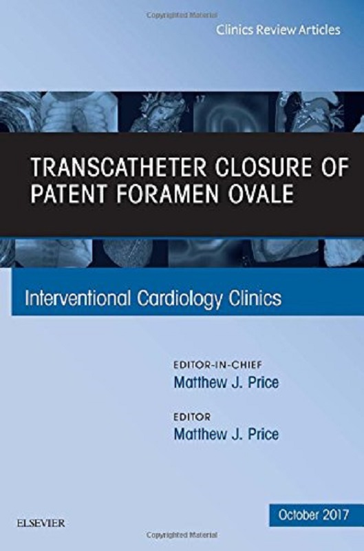预定transcatheter closure of patent foramen ovale, an issue of