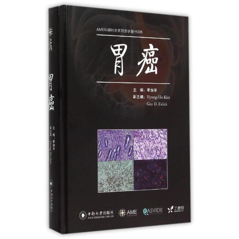 AME科研时间系列医学图书 005 胃癌 中南大学出版社 