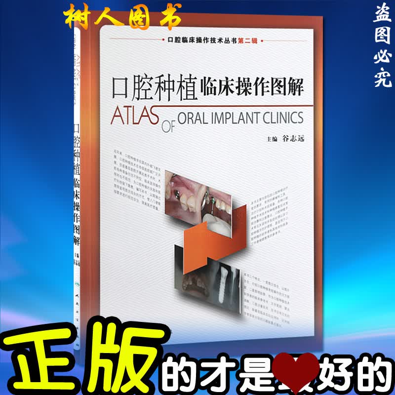 口腔种植临床操作图解 谷志远 口腔临床操作技术丛书 人民卫生出版社