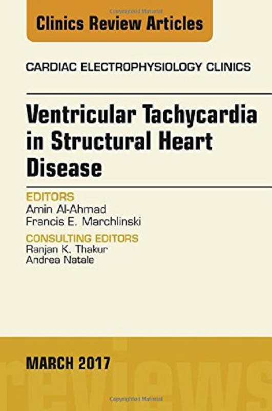 预定ventricular tachycardia in structural heart disease, an