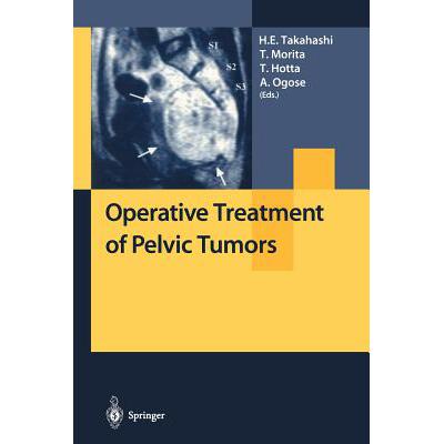 预订 Operative Treatment of Pelvic Tumors