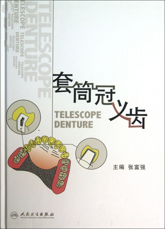 套筒冠义齿(精)