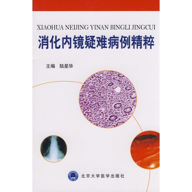 消化内镜疑难病例精粹
