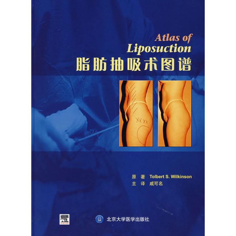 脂肪抽吸术图谱(E)