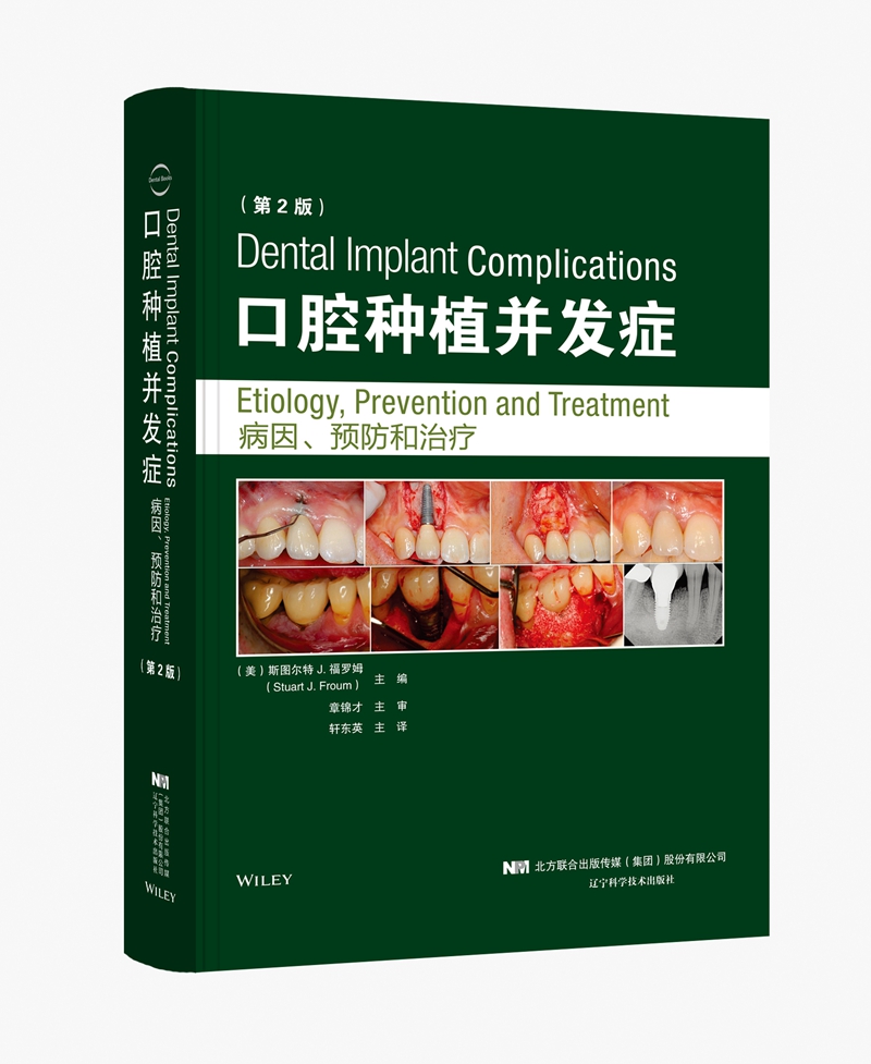口腔种植并发症 病因、预防和治疗 第二版