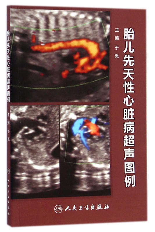 胎儿先天性心脏病超声图例