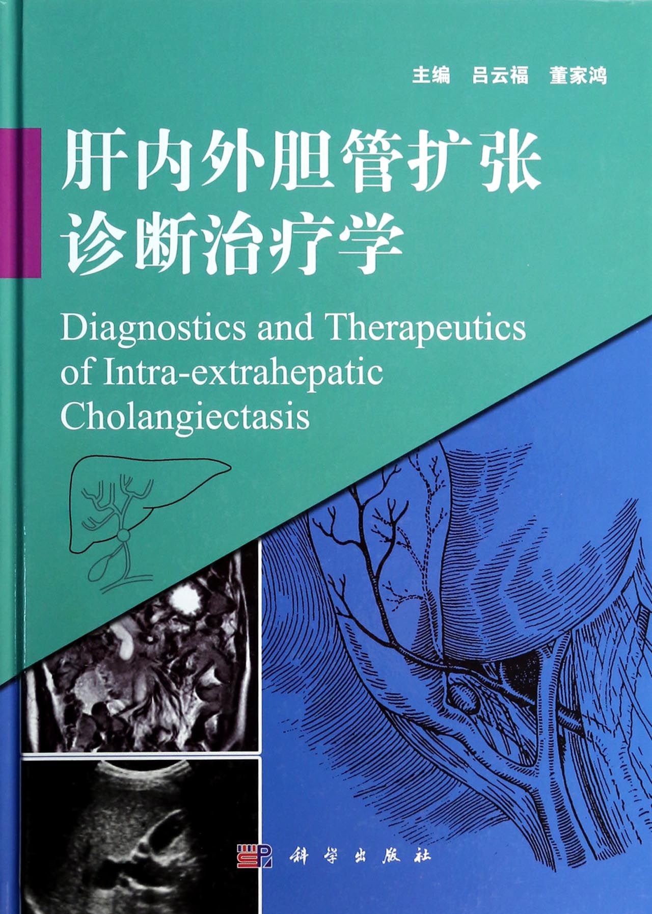 肝内外胆管扩张诊断治疗学(精)