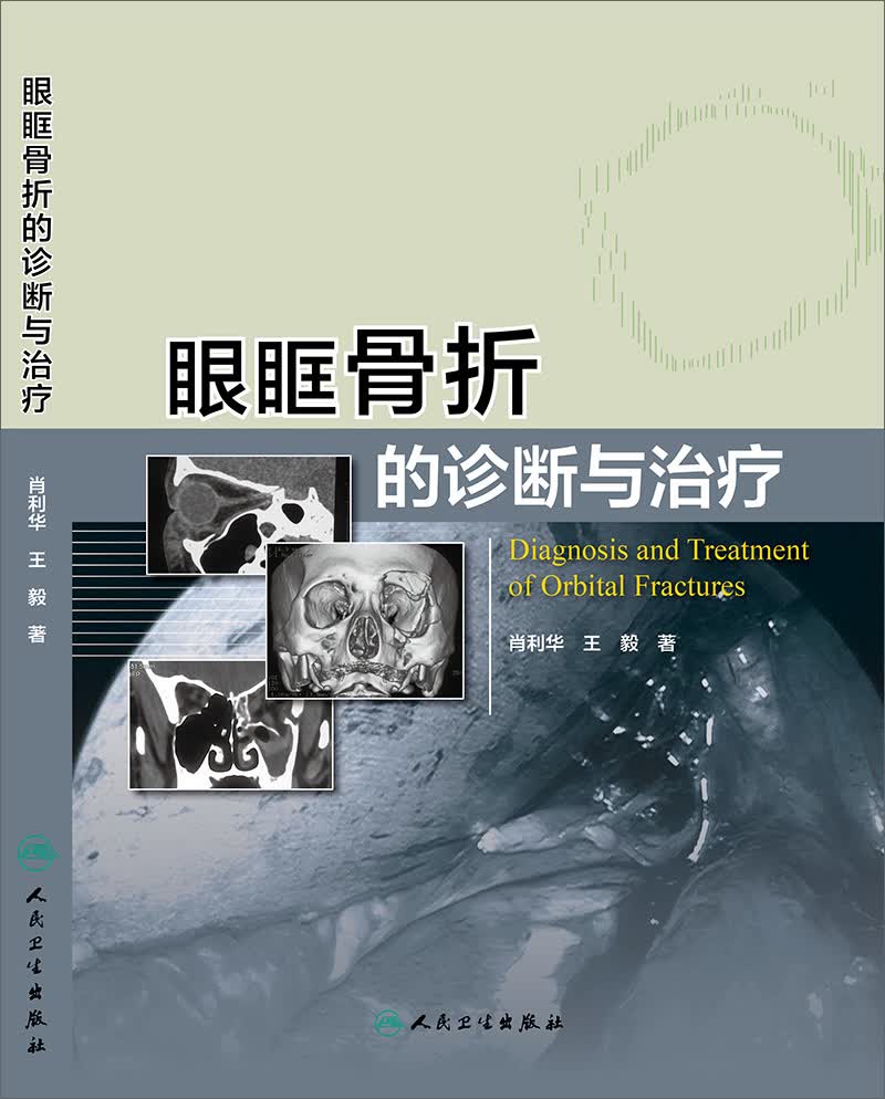 [正版图书]眼眶骨折的诊断与治疗
