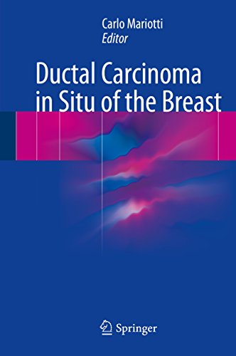 ductalcarcinoma图片