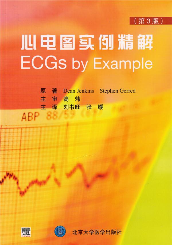 心电图实例精解（E）