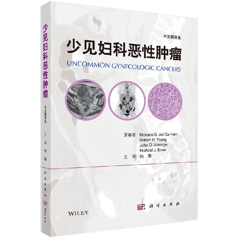 少见妇科恶性肿瘤 向阳译