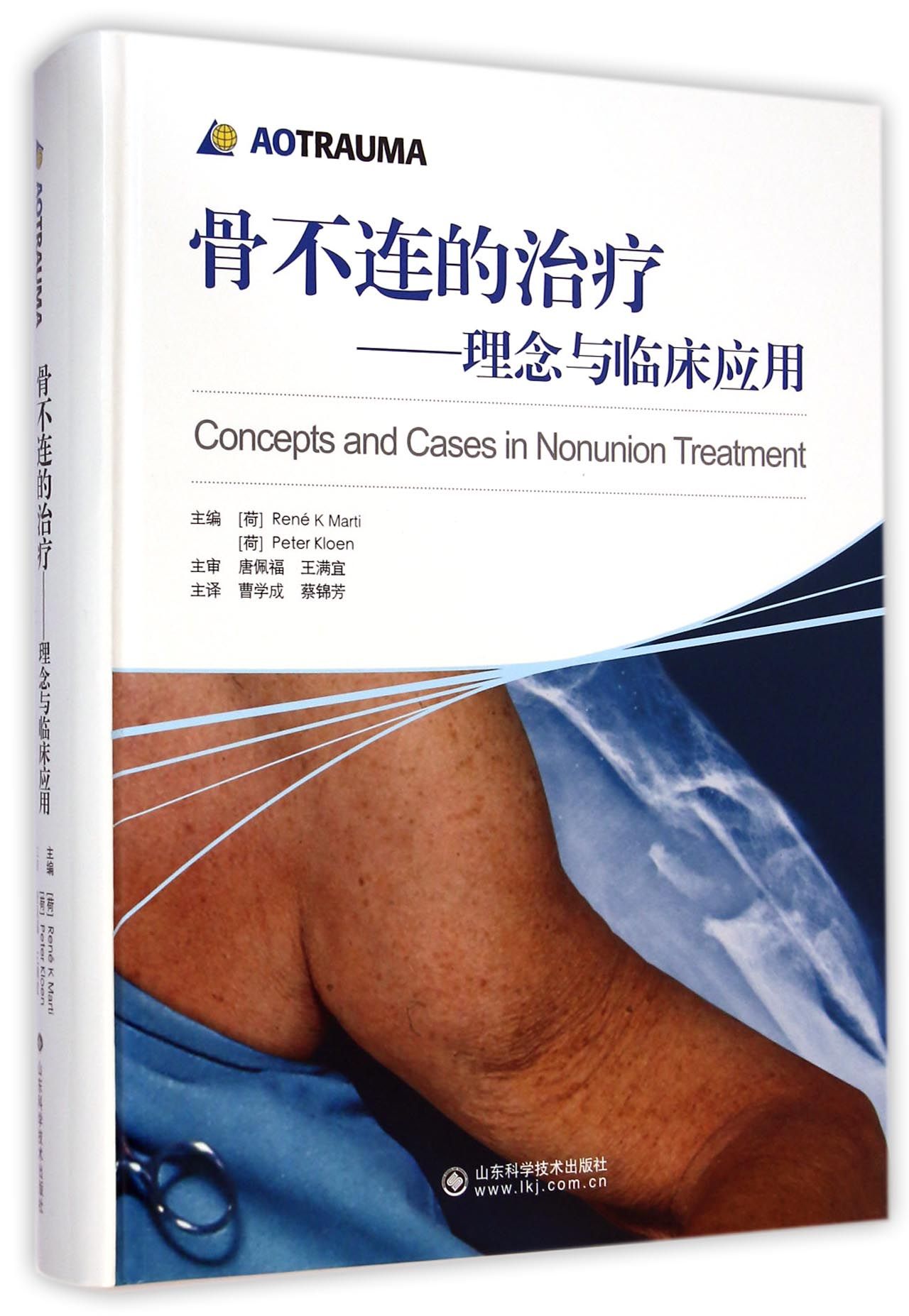 骨不连的治疗--理念与临床应用(精)