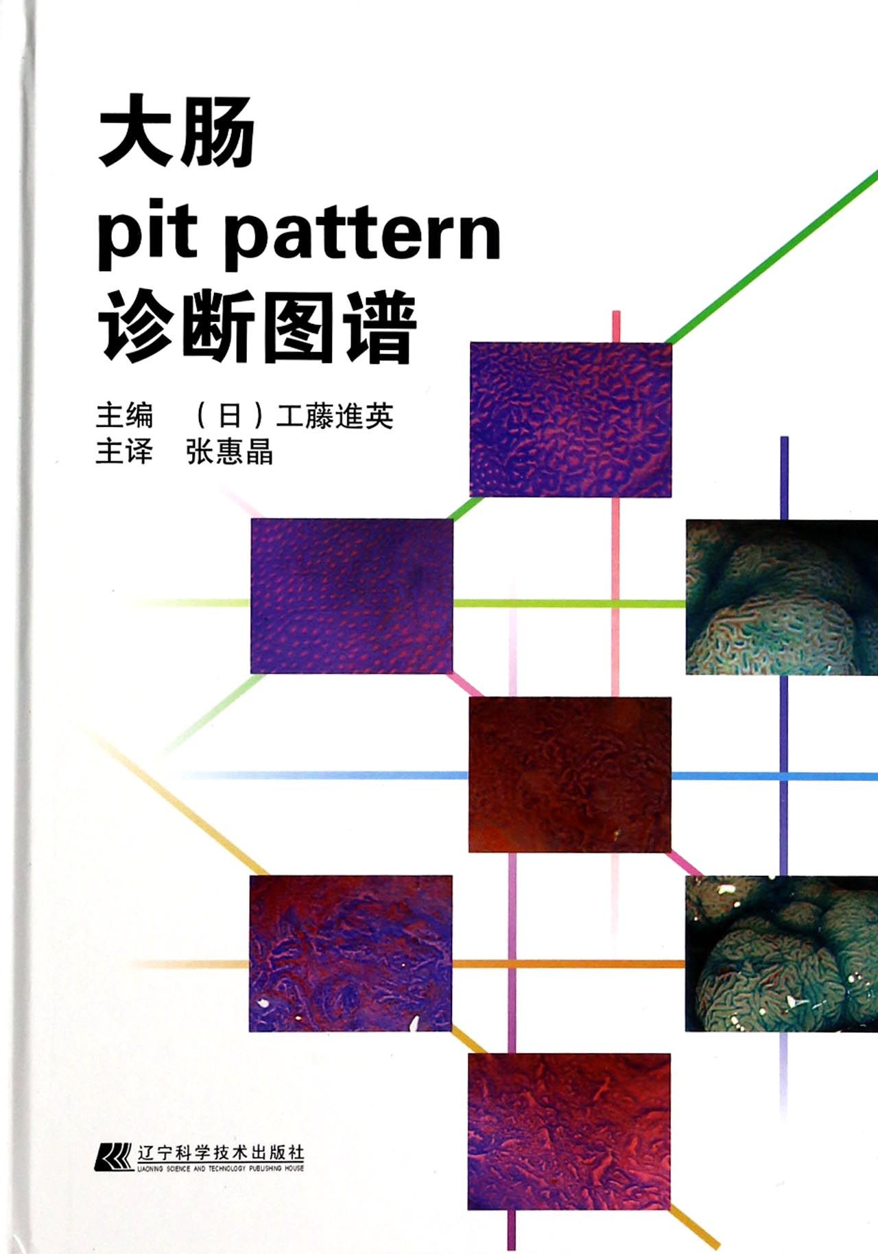 大肠pit pattern诊断图谱(精)