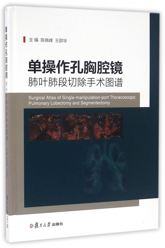 单操作孔胸腔镜肺叶肺段切除手术图谱(精)