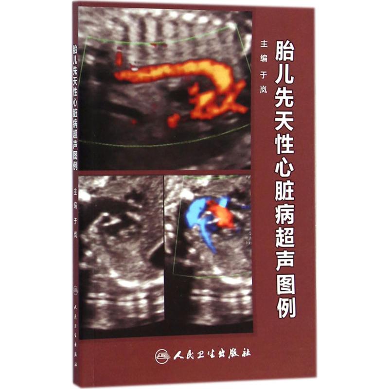 胎儿先天性心脏病超声图例