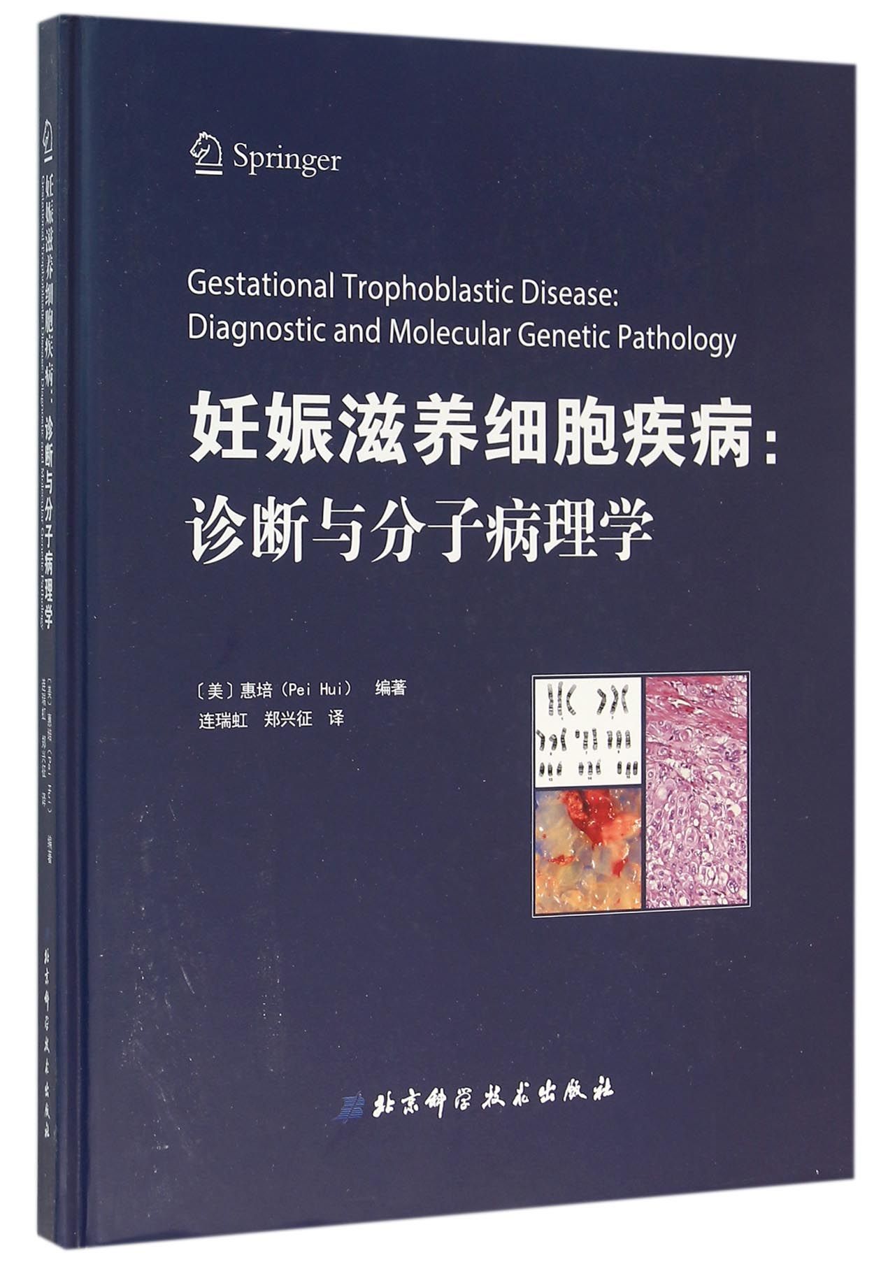 妊娠滋养细胞疾病--诊断与分子病理学(精)