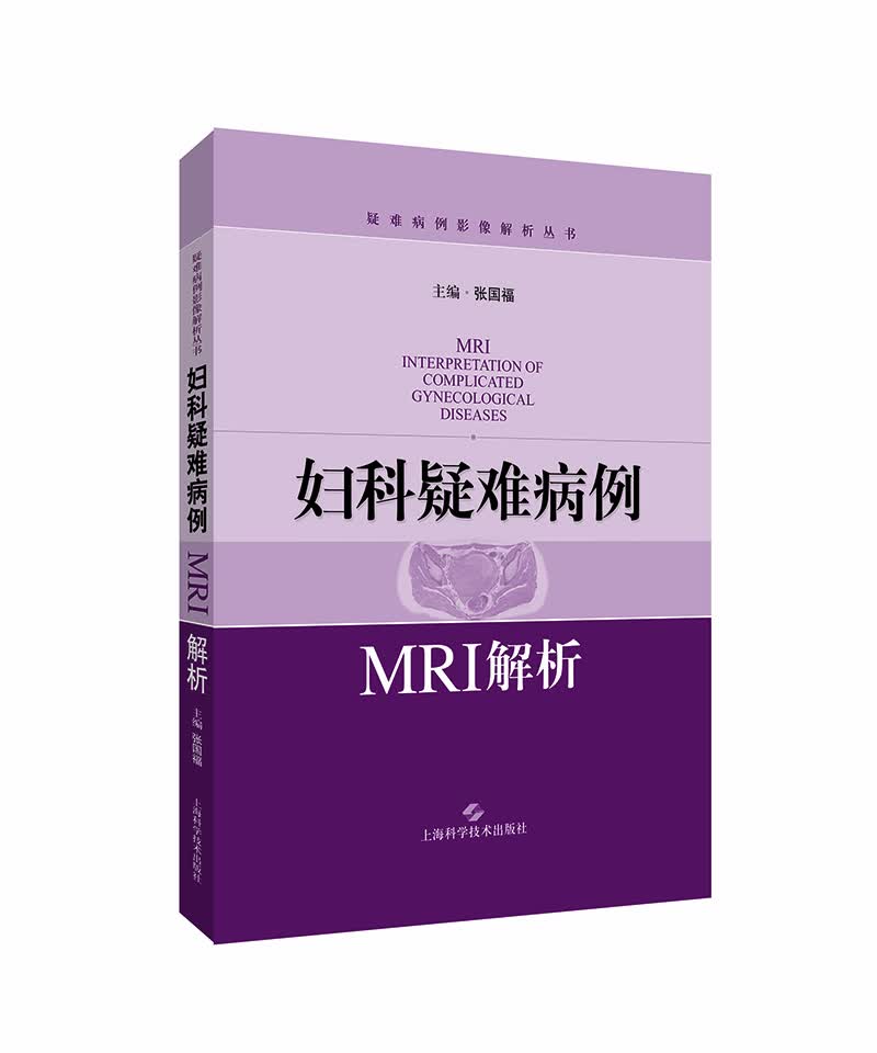 妇科疑难病例MRI解析