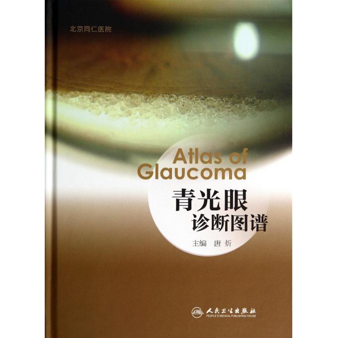 青光眼诊断图谱(精)