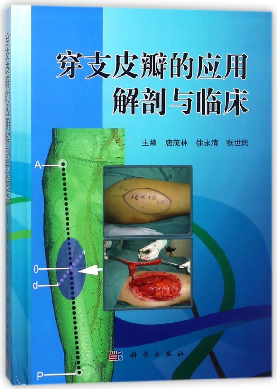 穿支皮瓣的应用解剖与临床(精)