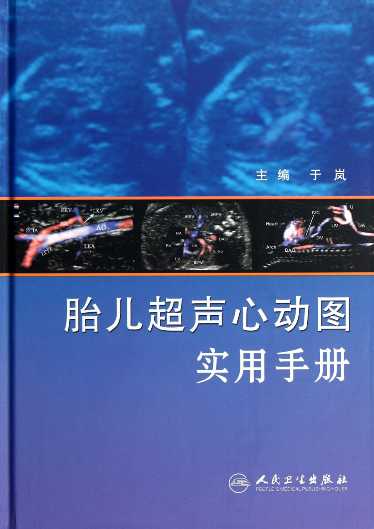 胎儿超声心动图实用手册(精)